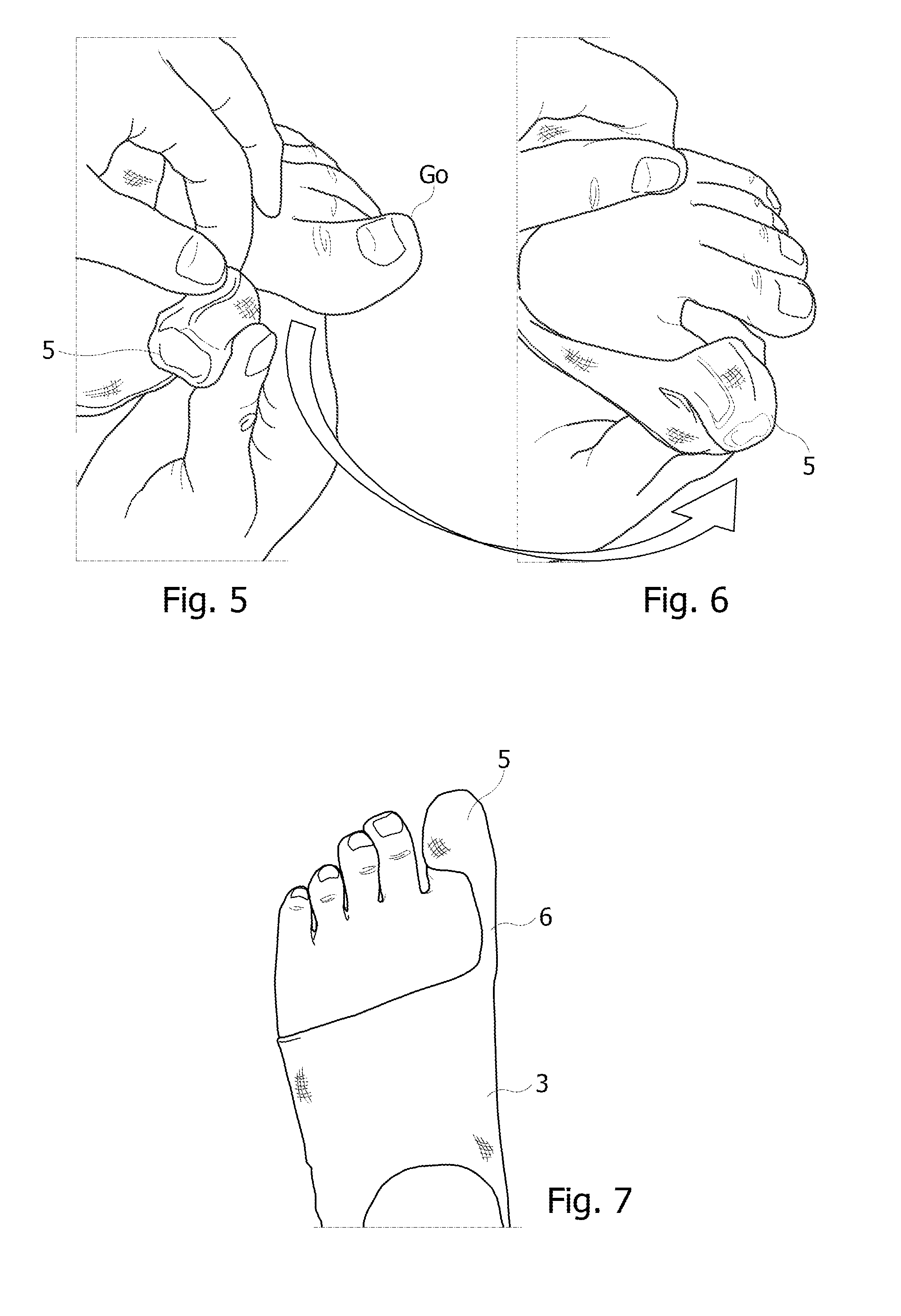 Orthopedic device for the mechanical treatment of hallux valgus