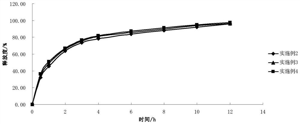 A sustained-release preparation for treating Alzheimer's disease and its preparation method