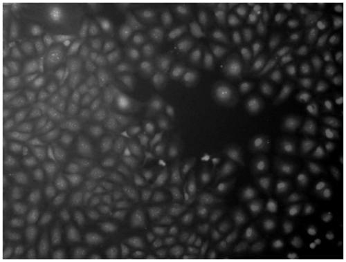 Preparing method of angiocarpy medical equipment surface Ti-Cu-N coating with antibacterial anticoagulation smooth muscle proliferation resistance functions