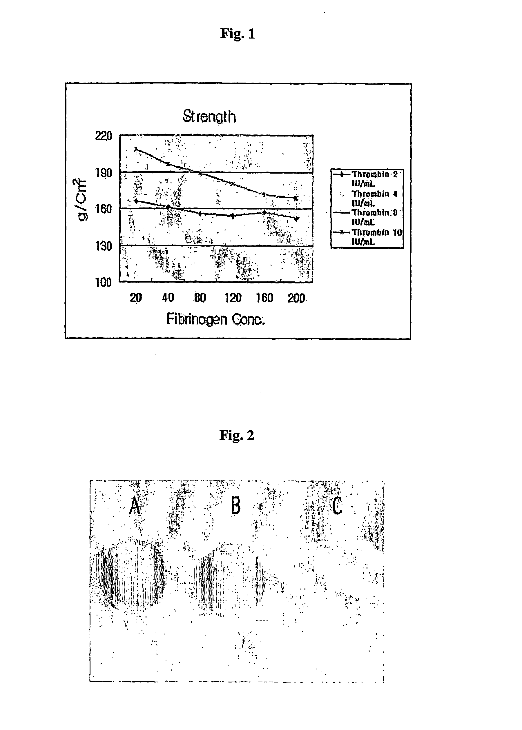 Composition of cartilage therapeutic agents and its application