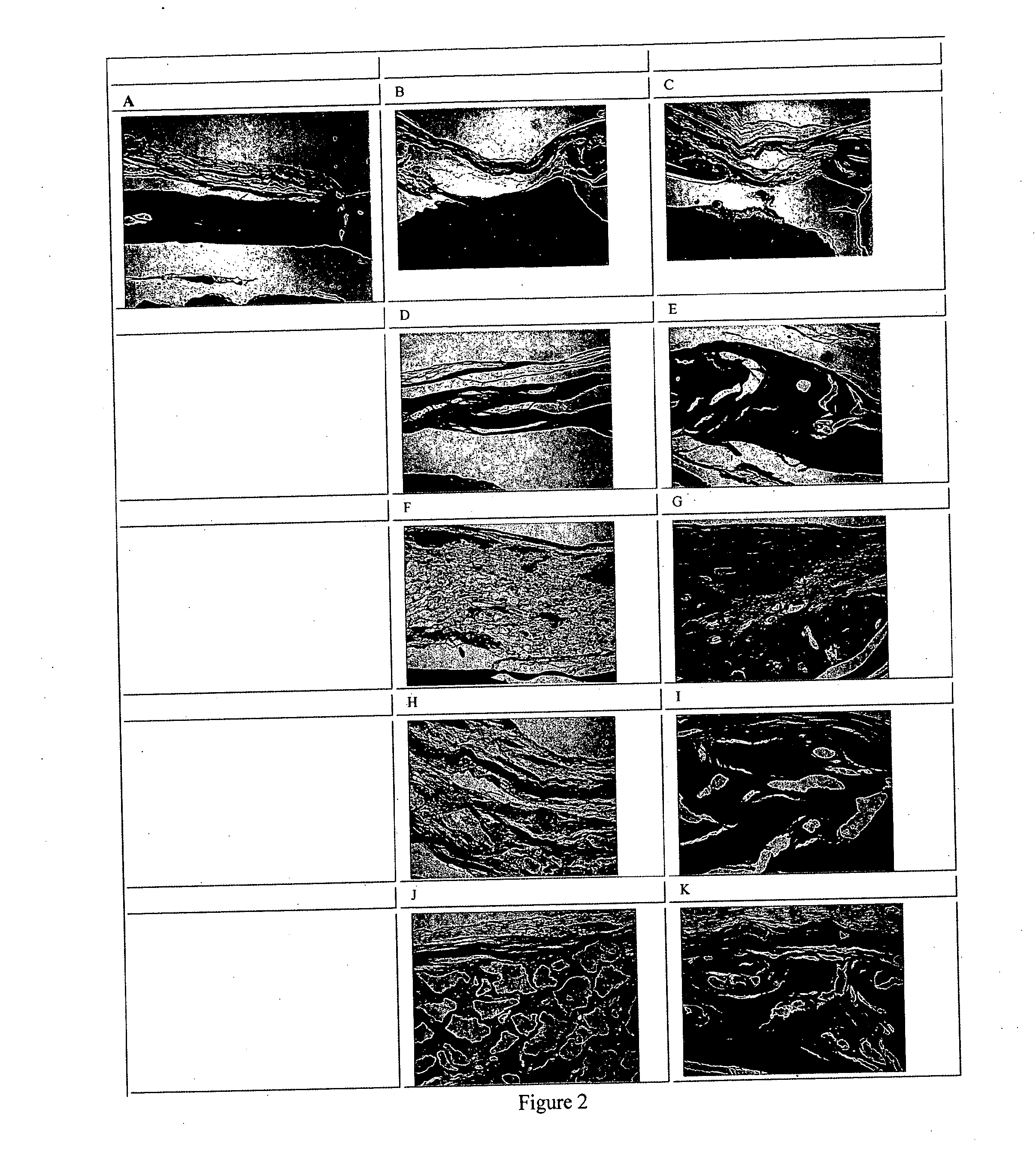 Purified Amphiphilic Peptide Compositions and Uses Thereof