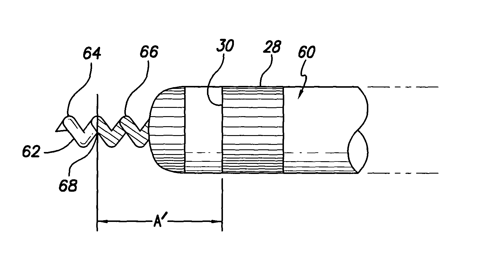 Medical electrical lead providing far-field signal attenuation