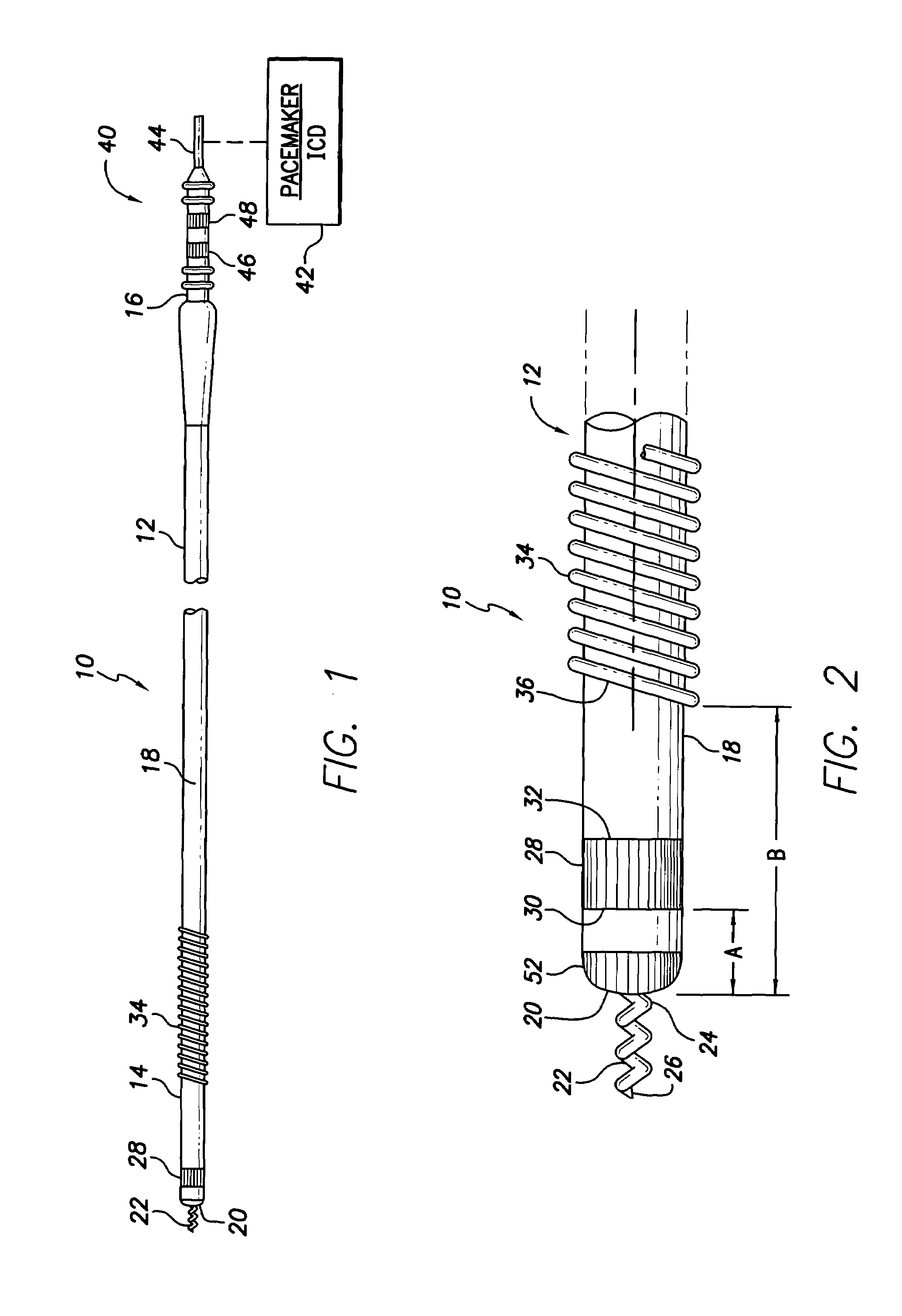 Medical electrical lead providing far-field signal attenuation