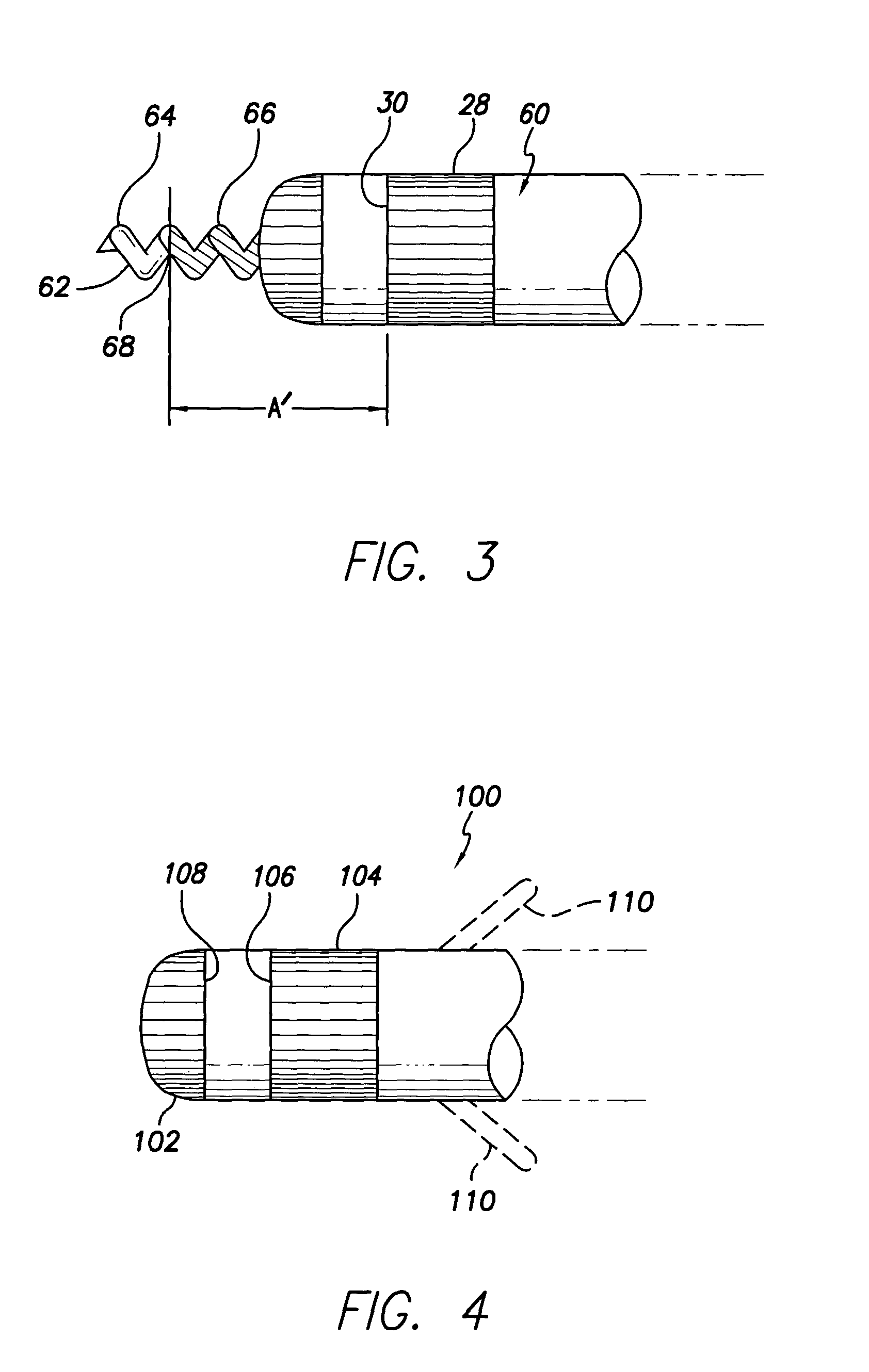 Medical electrical lead providing far-field signal attenuation