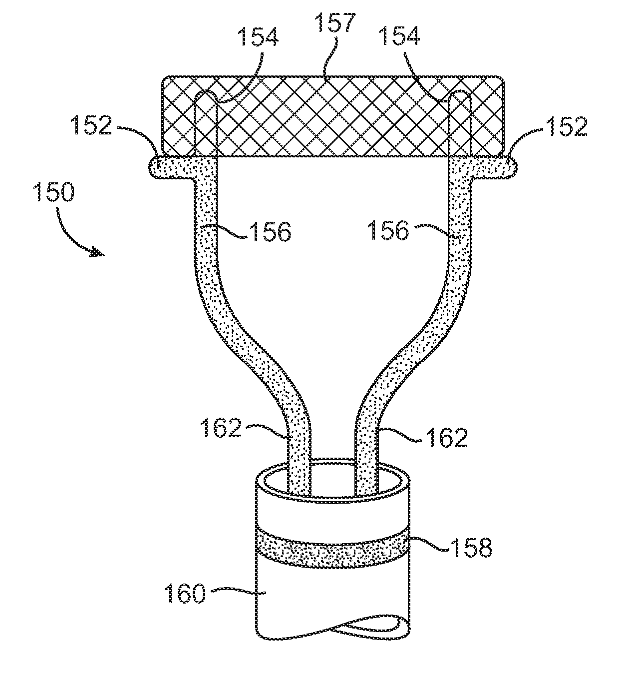 Methods and apparatus for closing a layered tissue defect