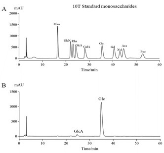 Application of insoluble dietary fiber in kelp in preparation of medicine and functional food for improving ulcerative colitis