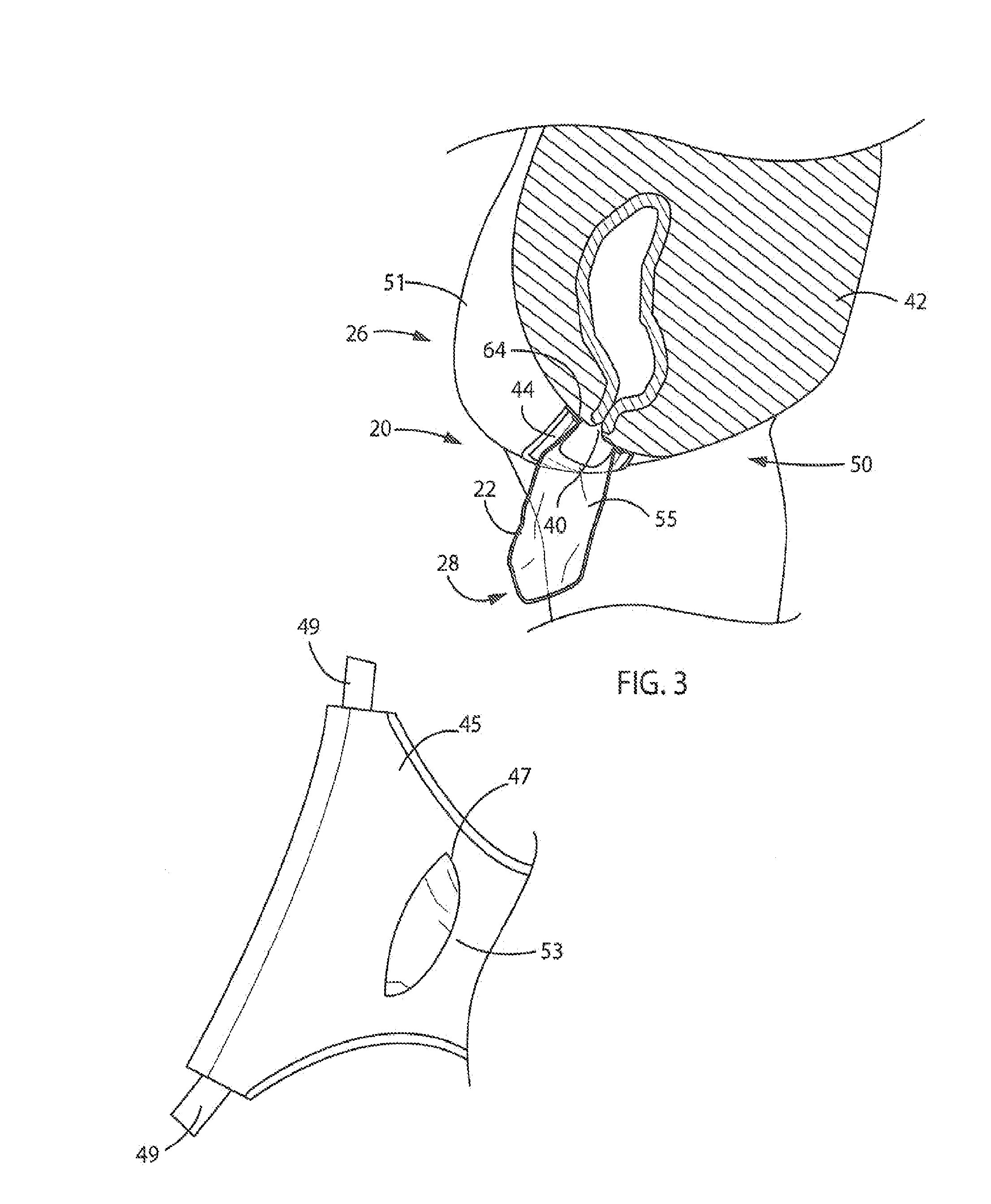 Fecal Matter Containment Device