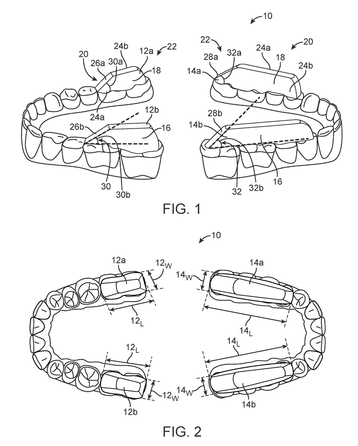 Combined orthodontic movement of teeth with temporomandibular joint therapy