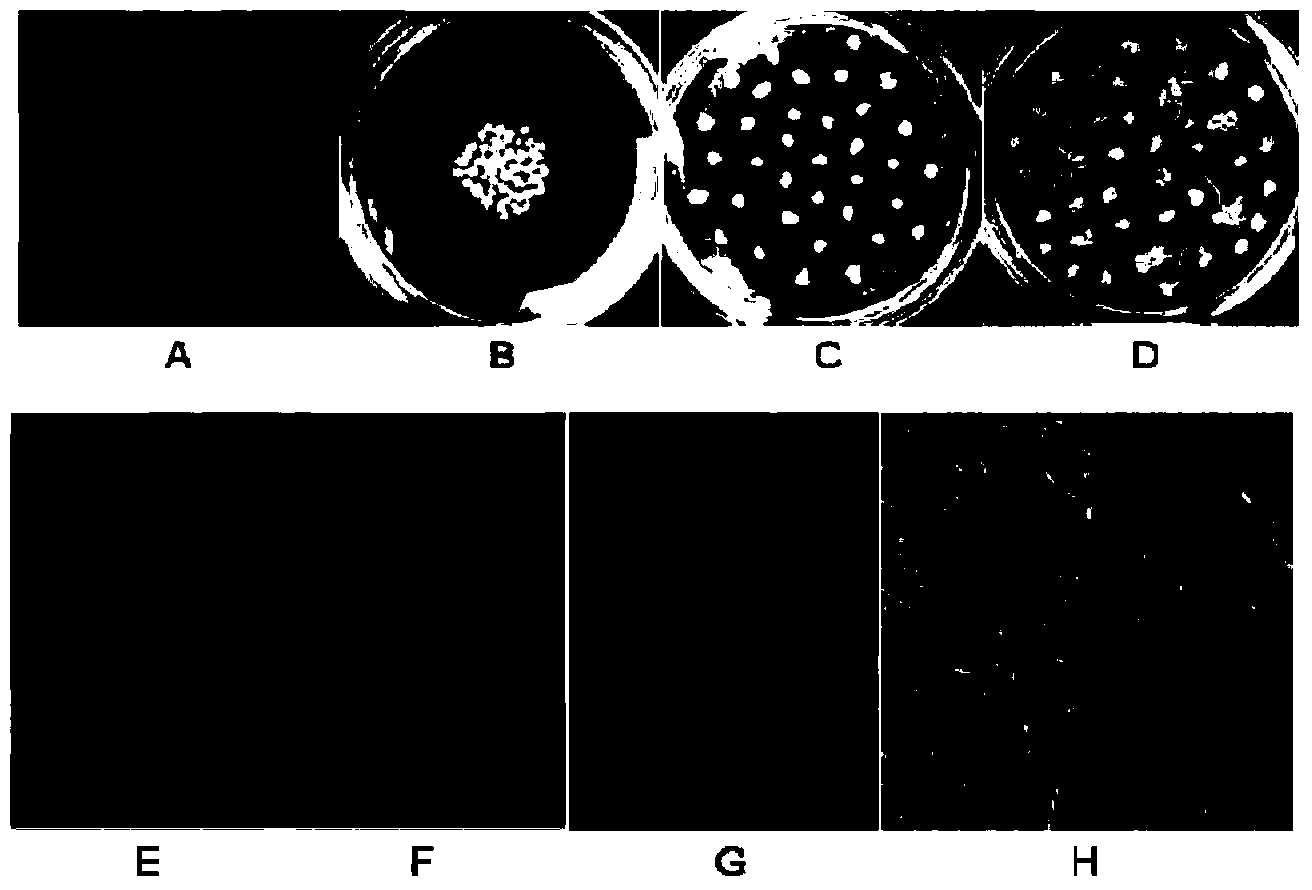 Application of yellow mosaic virus P2 protein and gene thereof in cultivation of wheat resistant to yellow mosaic disease