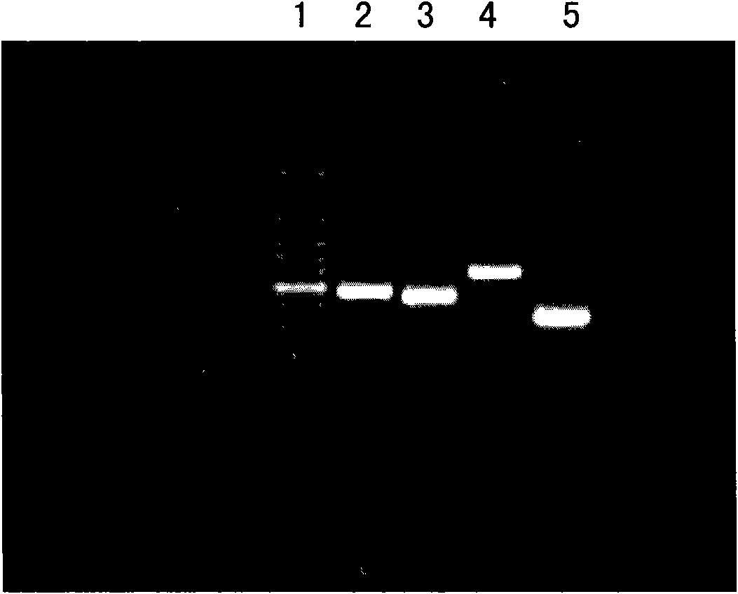 Detection method of gene mutation of mitochondrial succinate dehydrogenase and kit