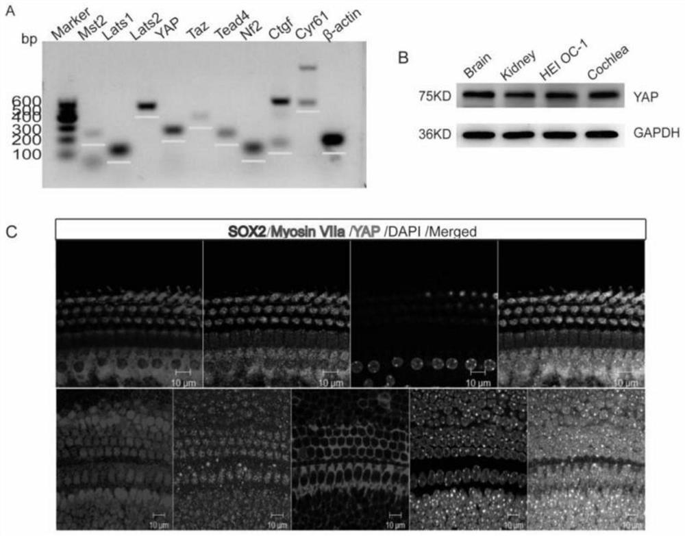 Method for regulating proliferation and differentiation of inner ear stem cells by Hippo and application of method in hair cell regeneration