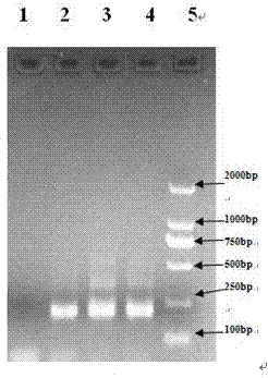 Extraction method of total genome DNA from microbes