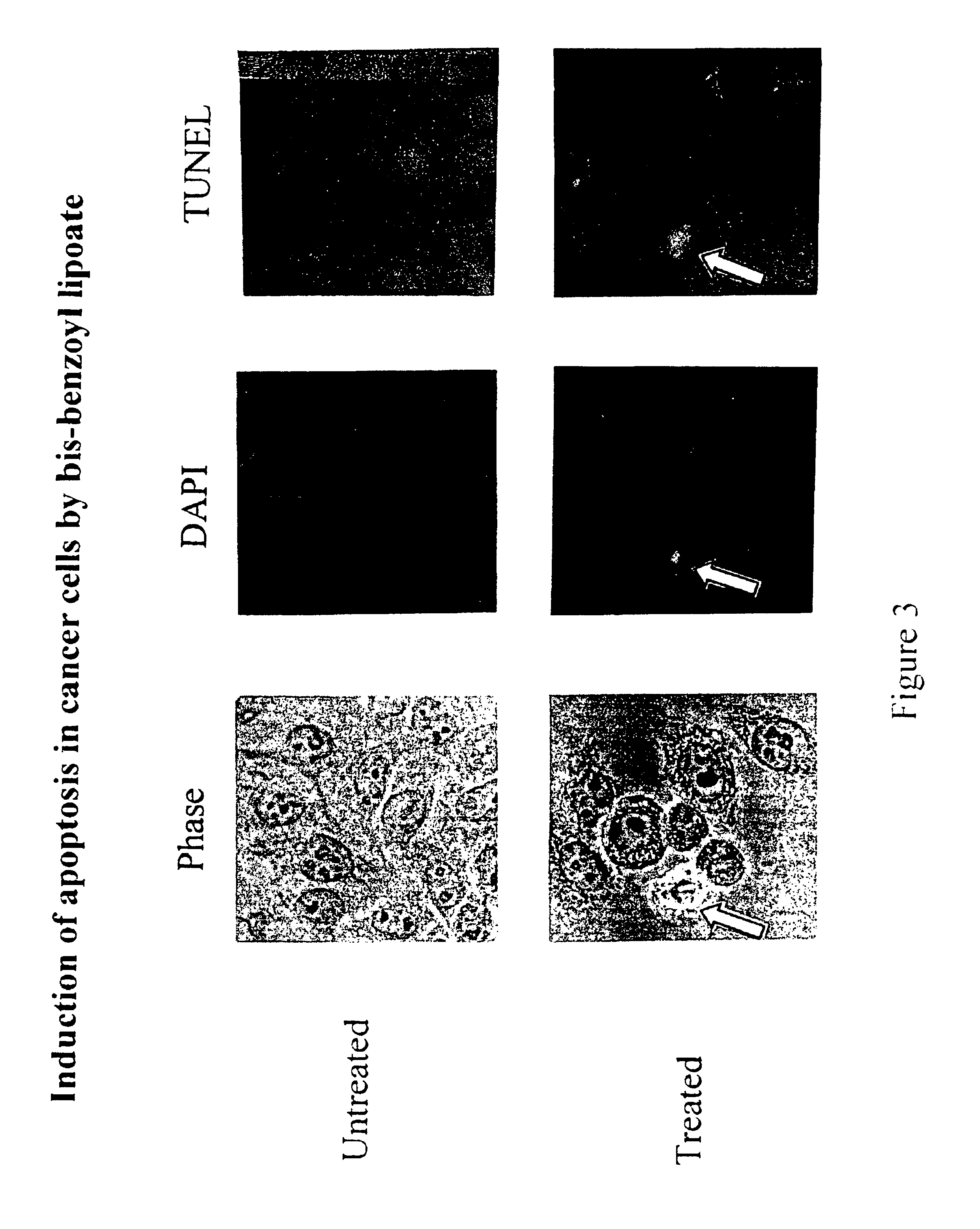 Lipoic acid derivatives and their use in treatment of disease