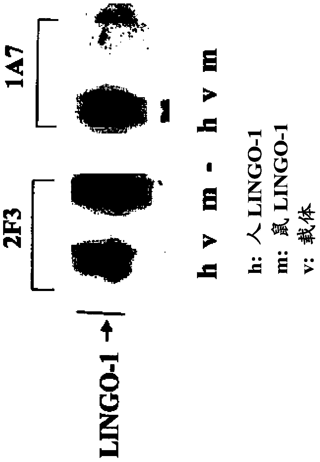 SP35 antibodies and uses thereof