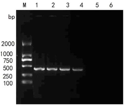 Duck hepatitis A virus type 2 detection kit and detection method thereof