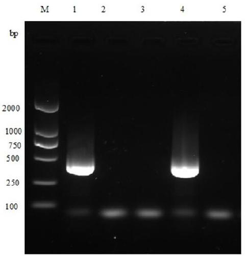 Duck hepatitis A virus type 2 detection kit and detection method thereof