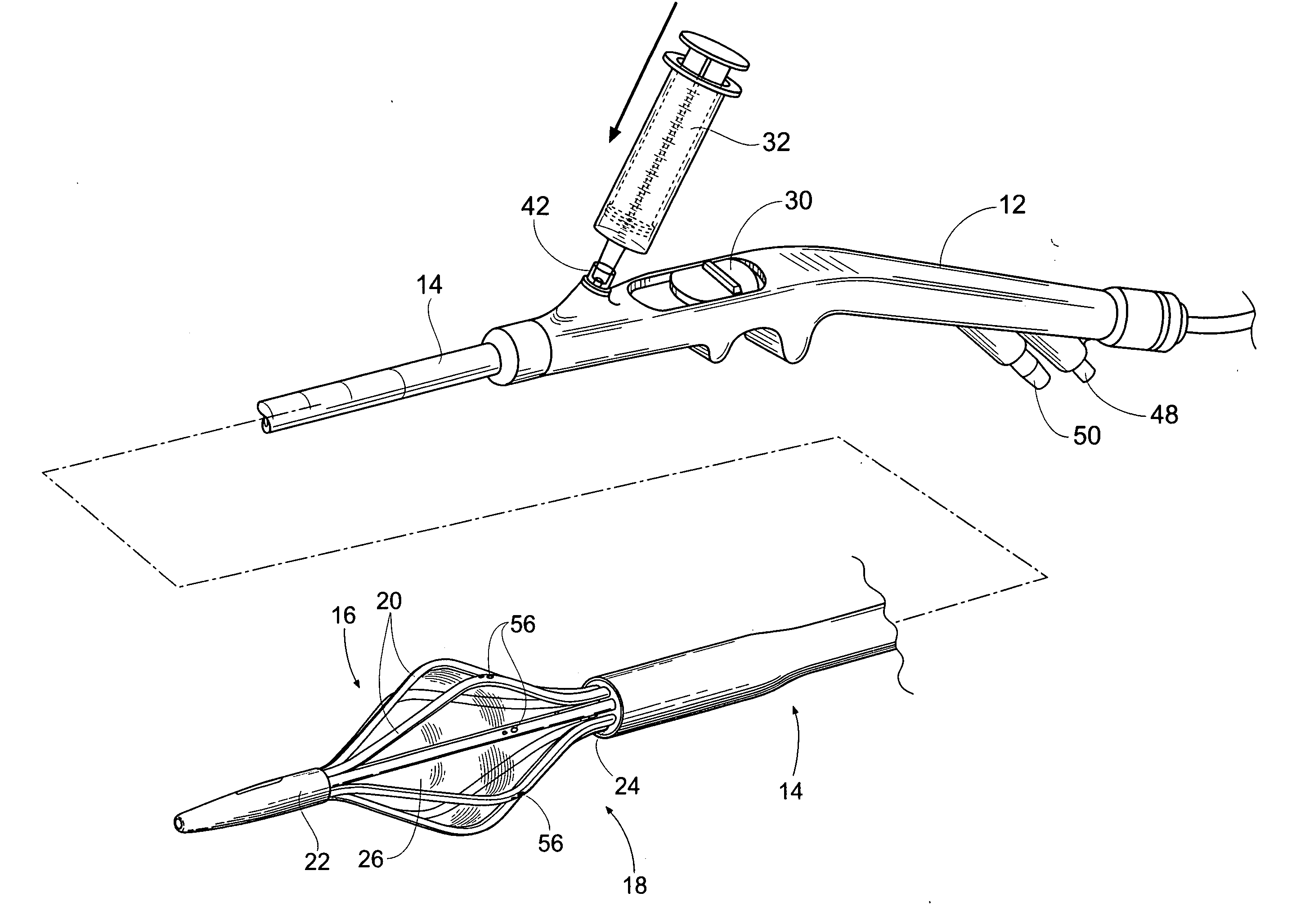 Systems and methods for treating tissue regions of the body