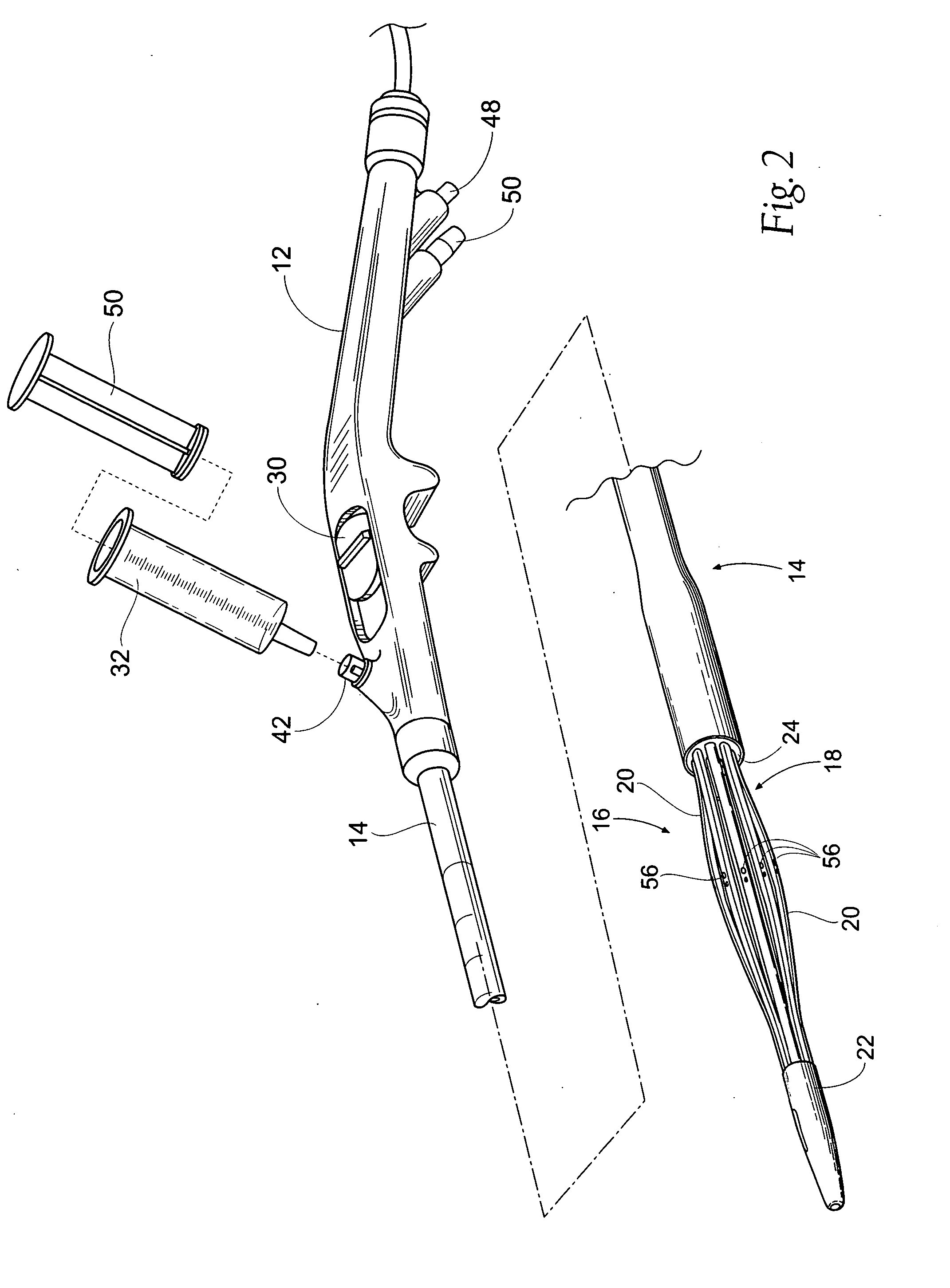 Systems and methods for treating tissue regions of the body