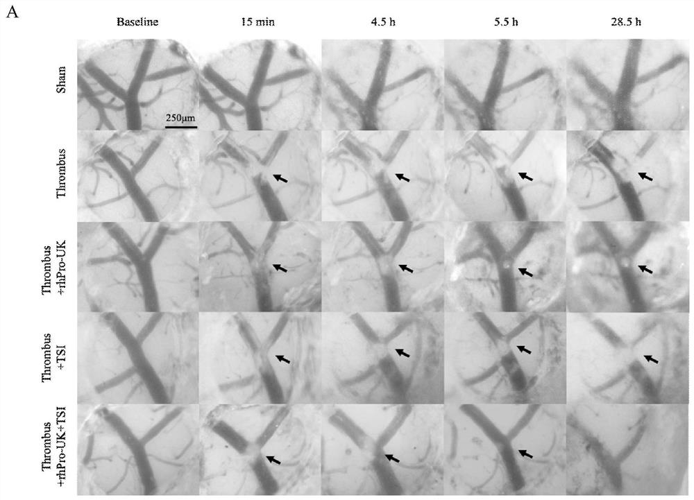 Pharmaceutical composition for ischemic stroke disease as well as preparation method and application of pharmaceutical composition