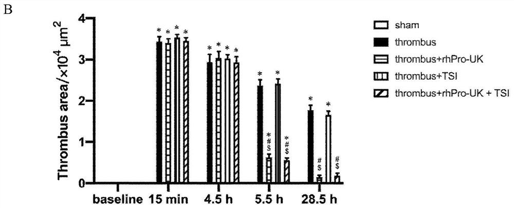 Pharmaceutical composition for ischemic stroke disease as well as preparation method and application of pharmaceutical composition