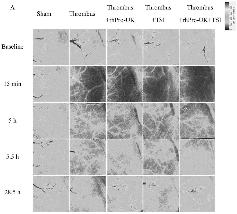 Pharmaceutical composition for ischemic stroke disease as well as preparation method and application of pharmaceutical composition