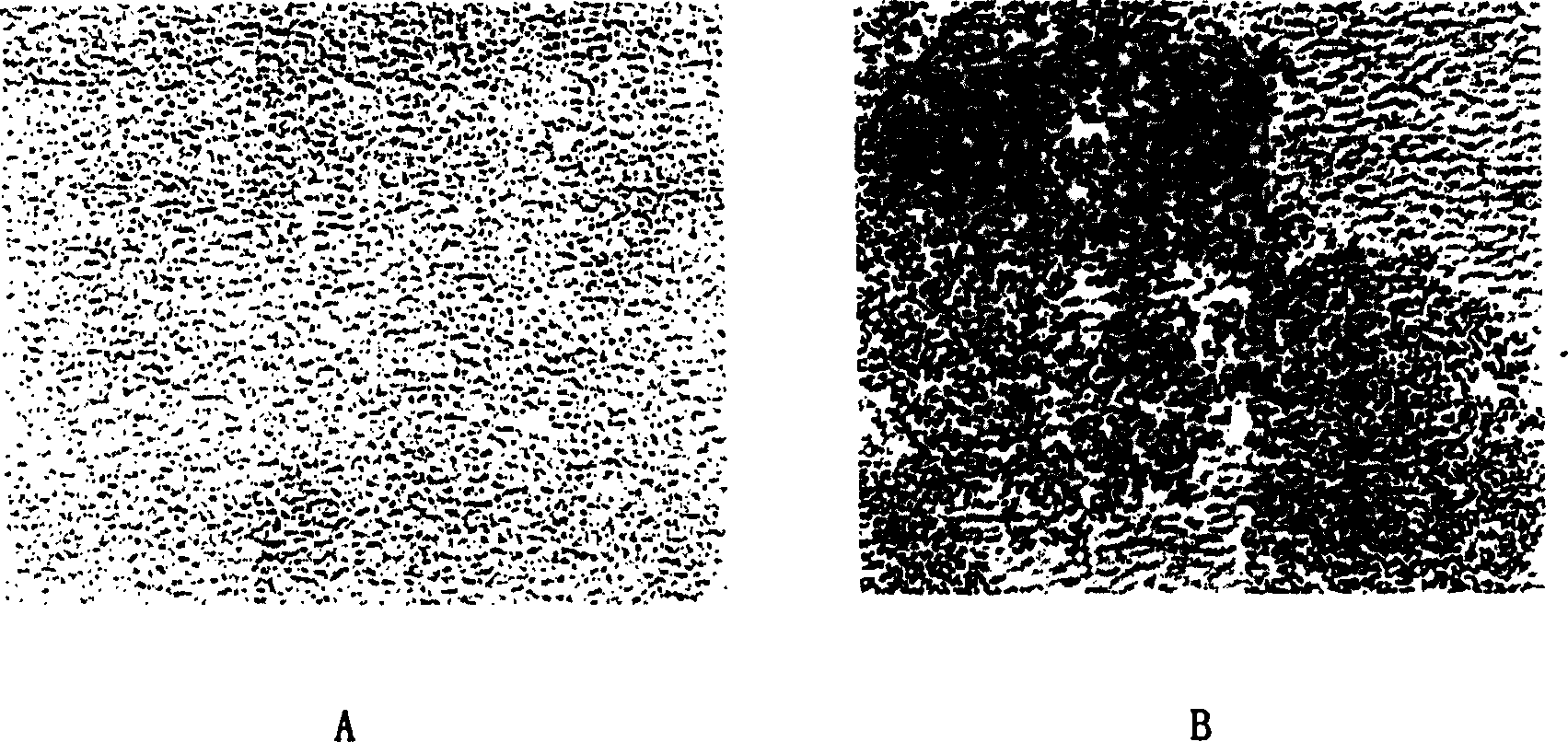 Immune microsphere in use for detecting SARS antigen, preparation method and application