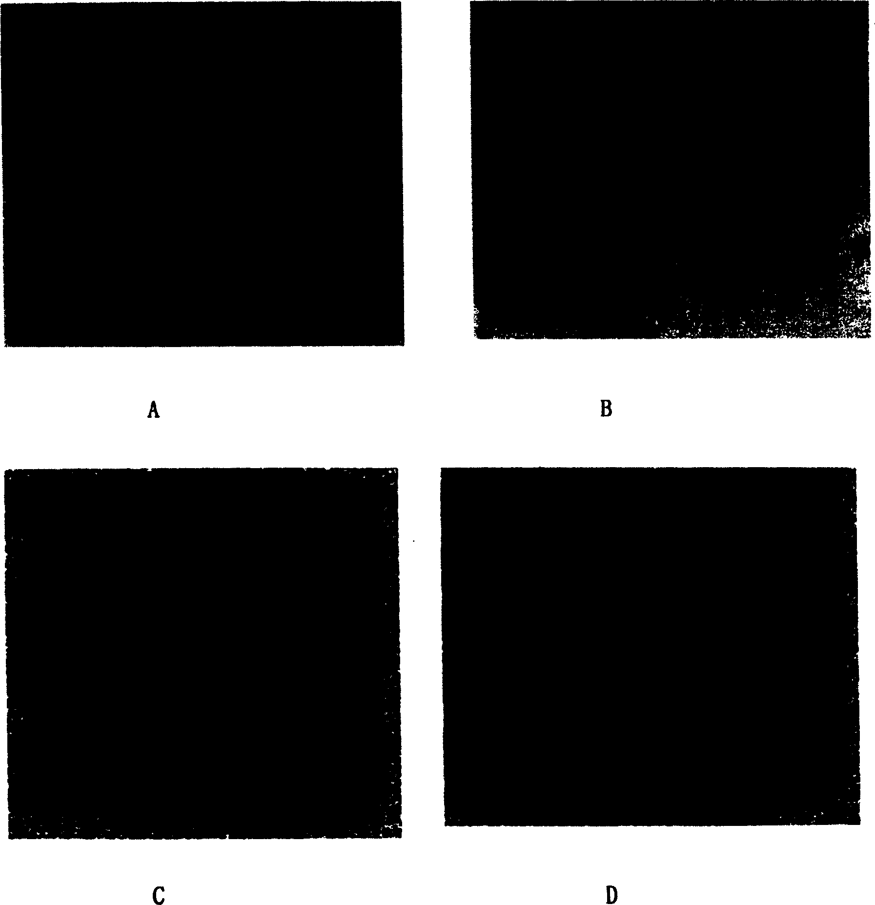 Immune microsphere in use for detecting SARS antigen, preparation method and application