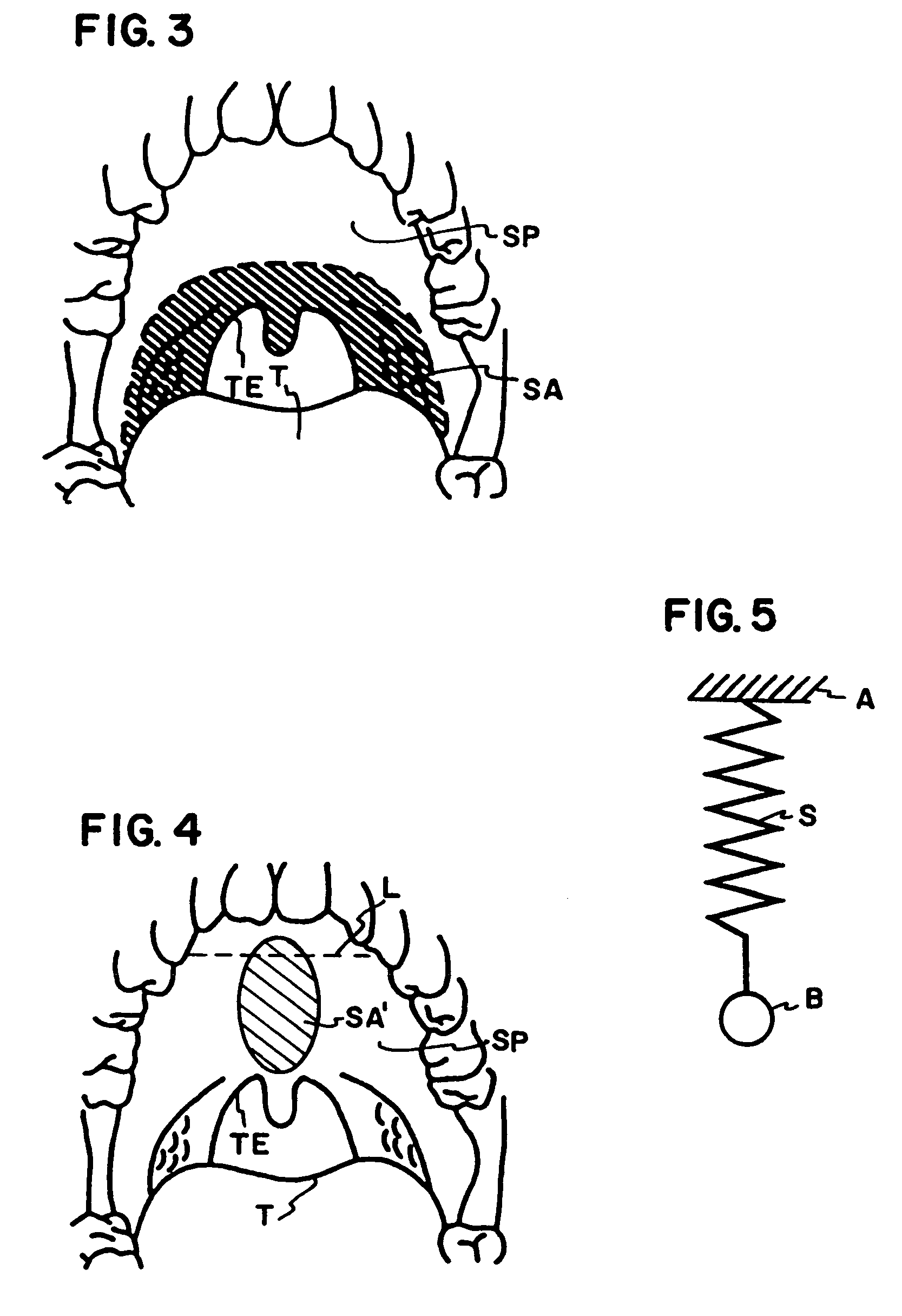 Method and apparatus to treat conditions of the naso-pharyngeal area