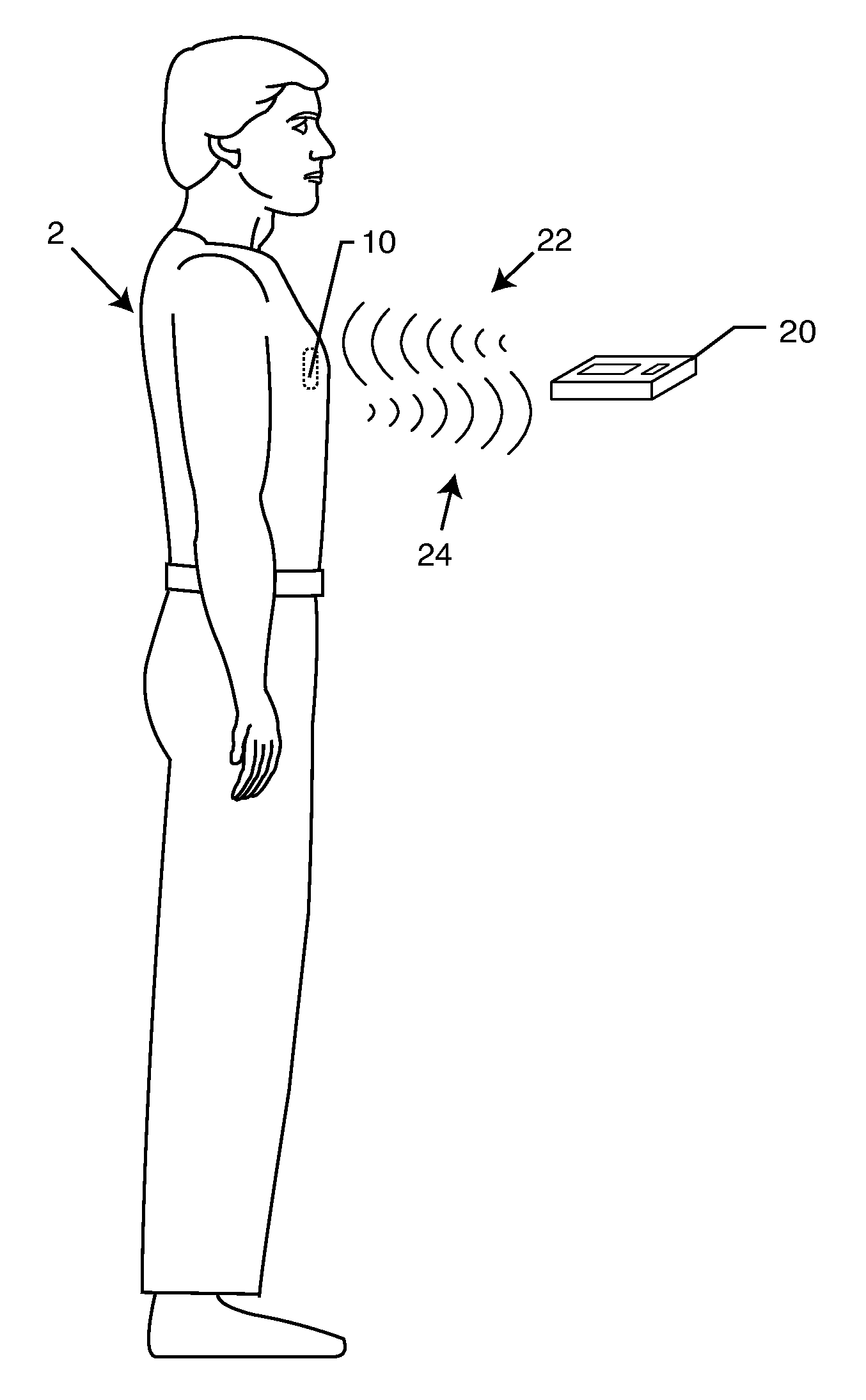 Implanted lead sleeve having RFID tag