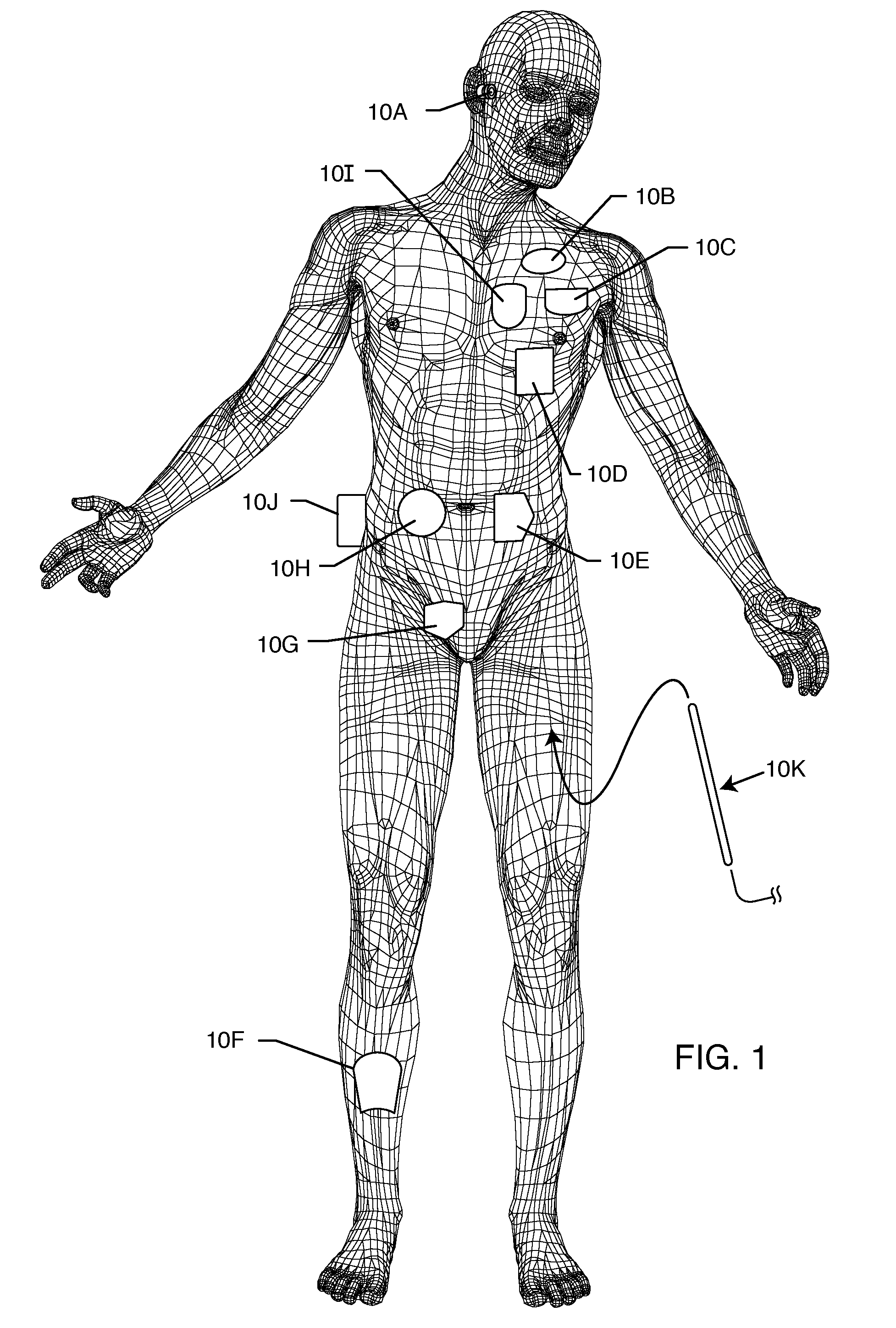 Implanted lead sleeve having RFID tag