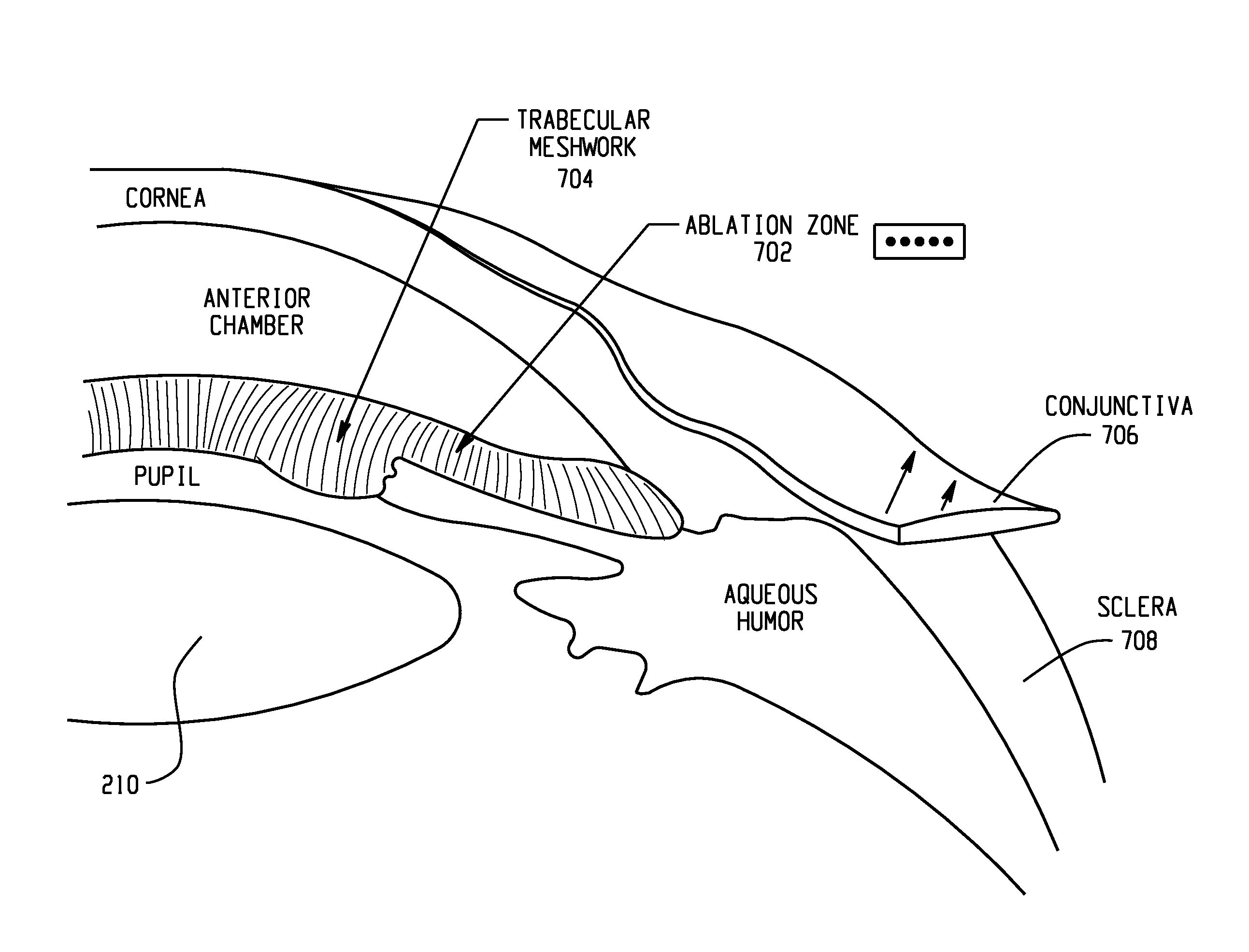 Methods for treating eye conditions