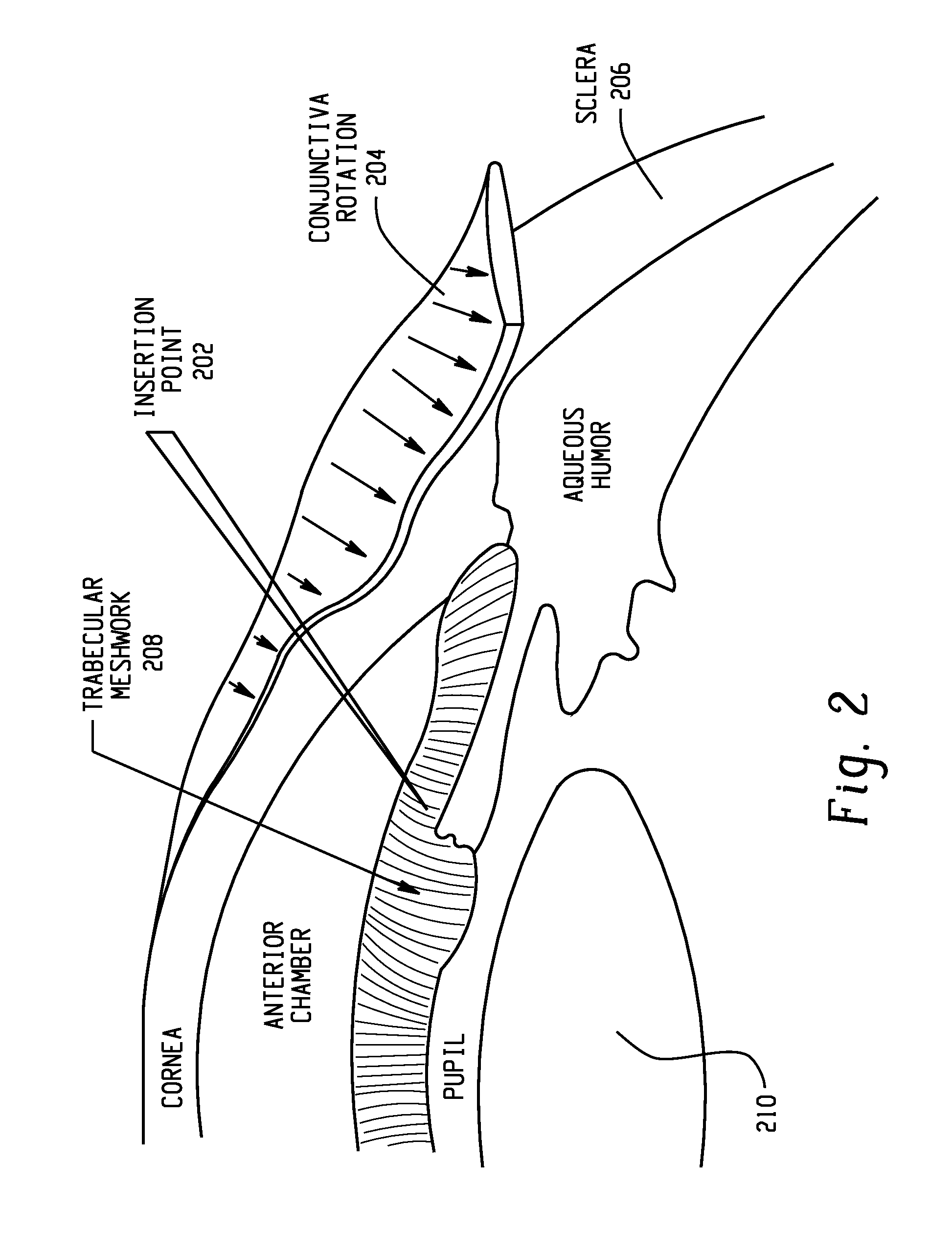 Methods for treating eye conditions