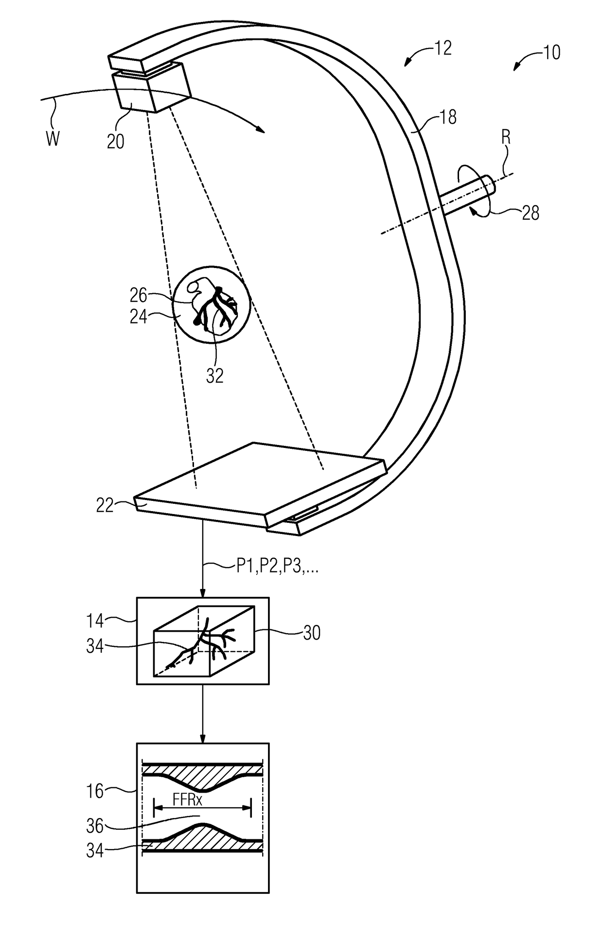 Fluid-dynamic analysis of a vascular tree using angiography