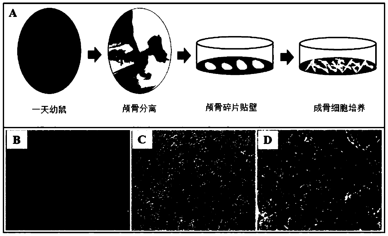 Preparation method and application of bionic composite nanofiber stent material