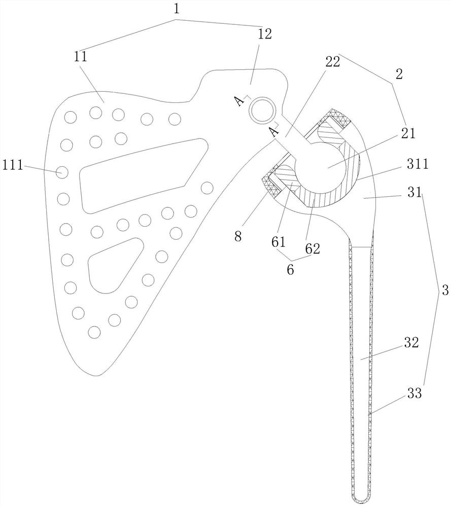 A kind of modular shoulder joint prosthesis and its manufacturing method