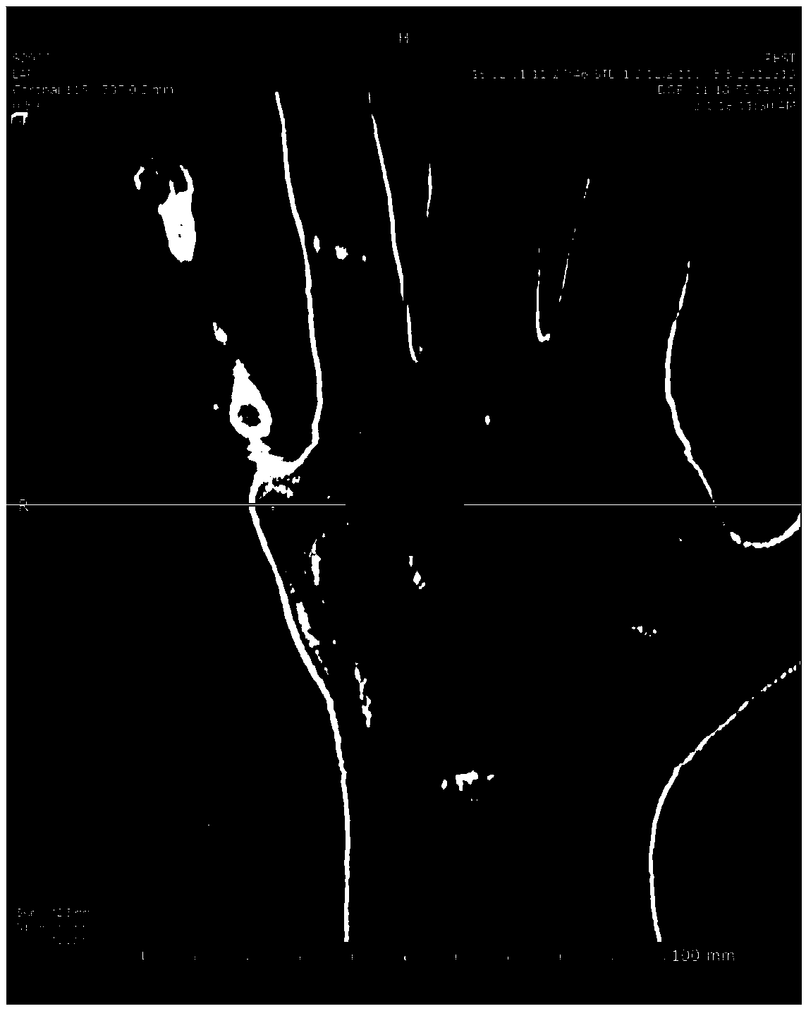 Ultrasonic bone age detection system and method