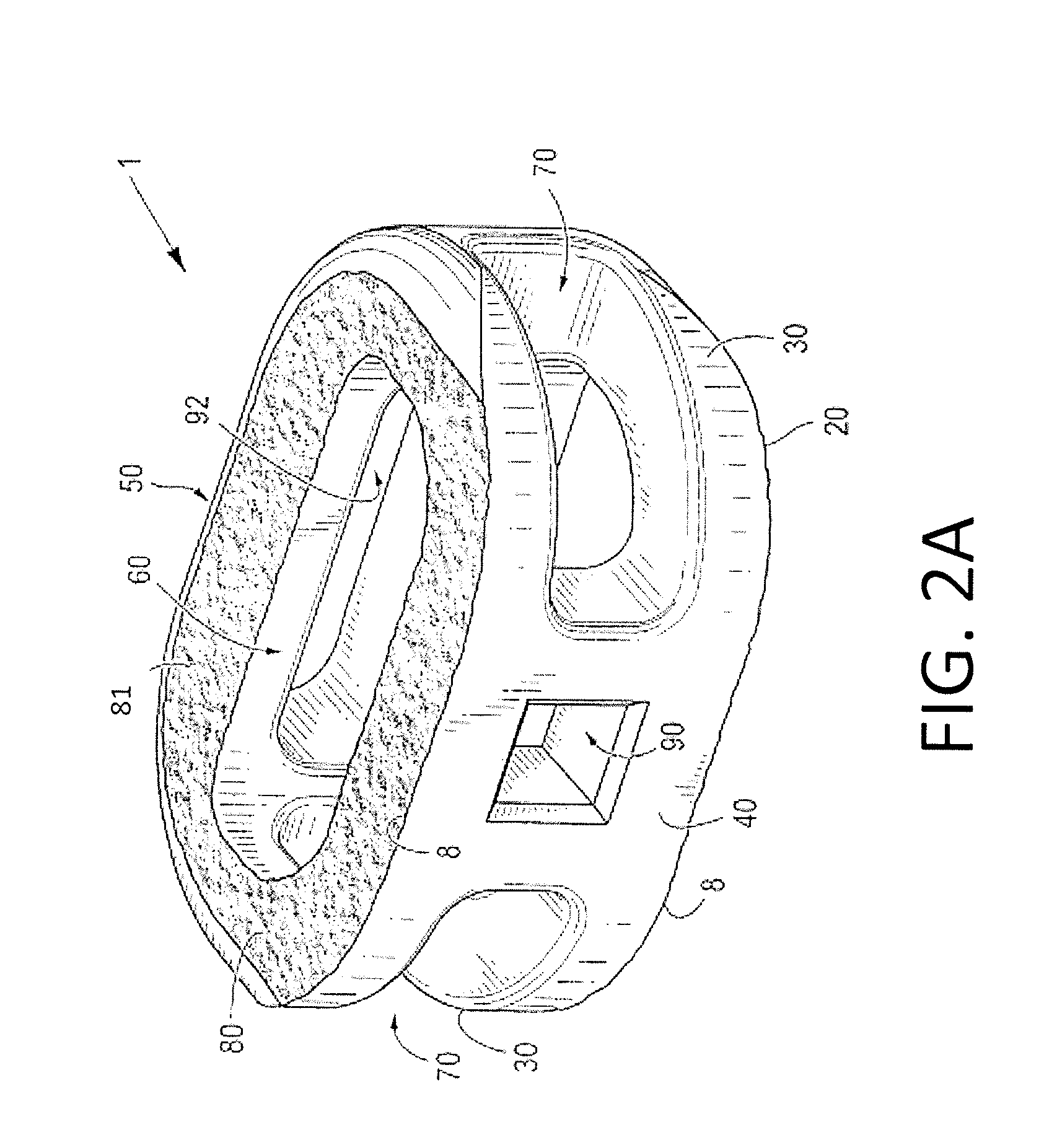 Process of fabricating implants having three distinct surfaces