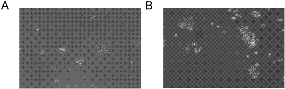 In-vitro individualized medicine test method for lung cancer and culture medium