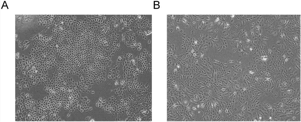 In-vitro individualized medicine test method for lung cancer and culture medium