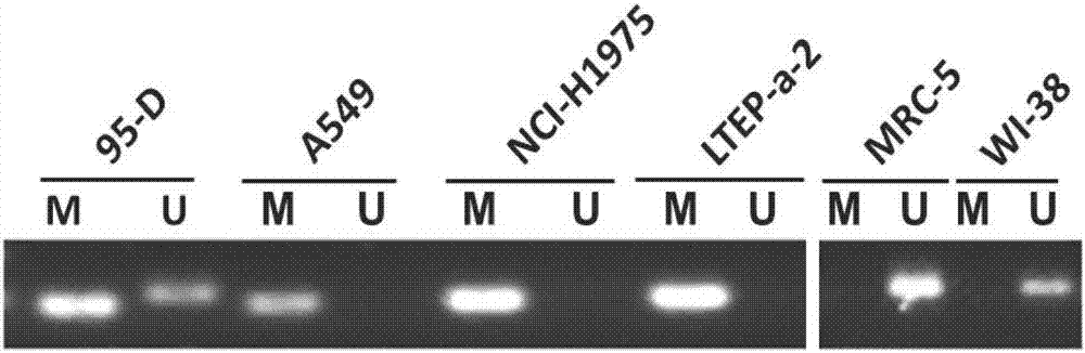 Application of HIC1 (hypermethylated in cancer 1) to diagnosis, treatment, prognosis and recurrence prediction of tumors