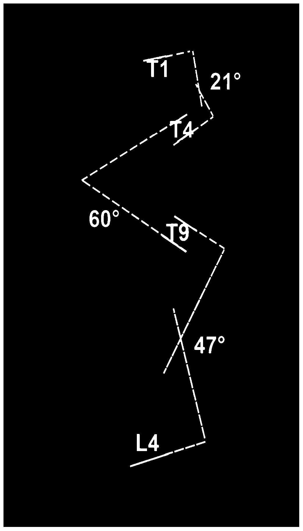 Spine Cobb angle measurement method and device, readable storage medium and terminal equipment