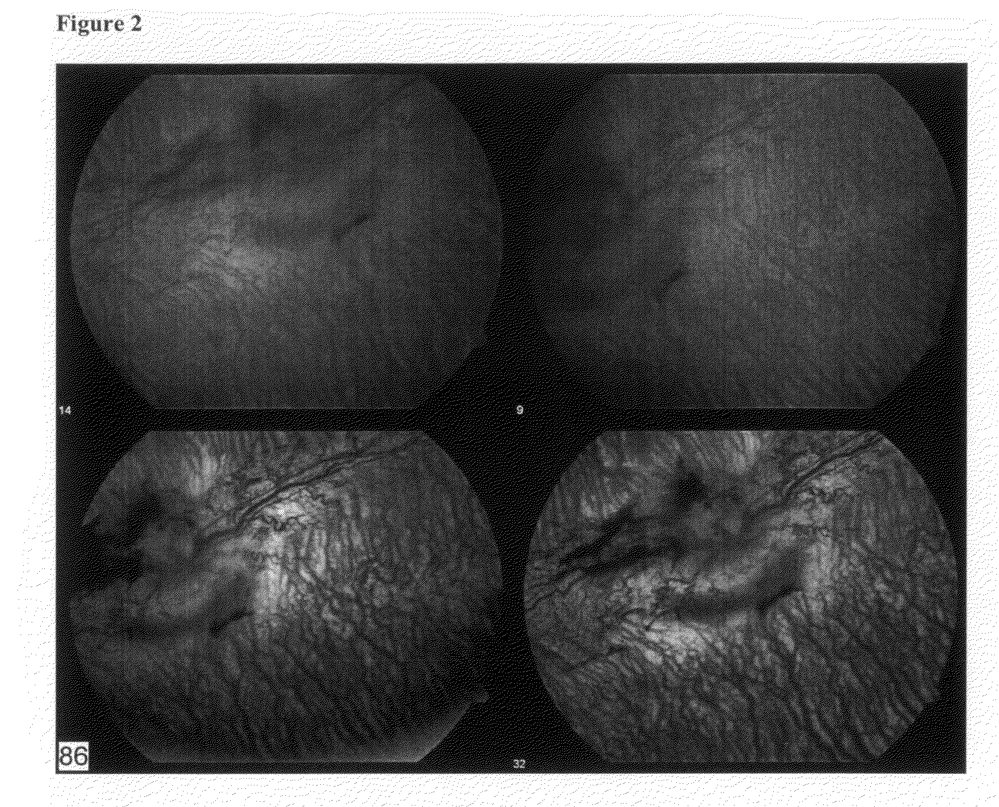 Compositions and methods for treating ophthalmic disorders