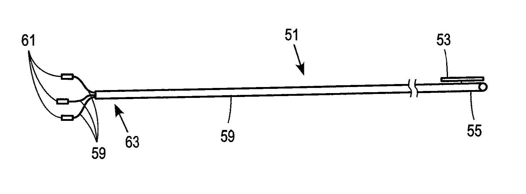 Catheter apparatus with telescoping lumen catheters and its use in methods for treating vasculatures