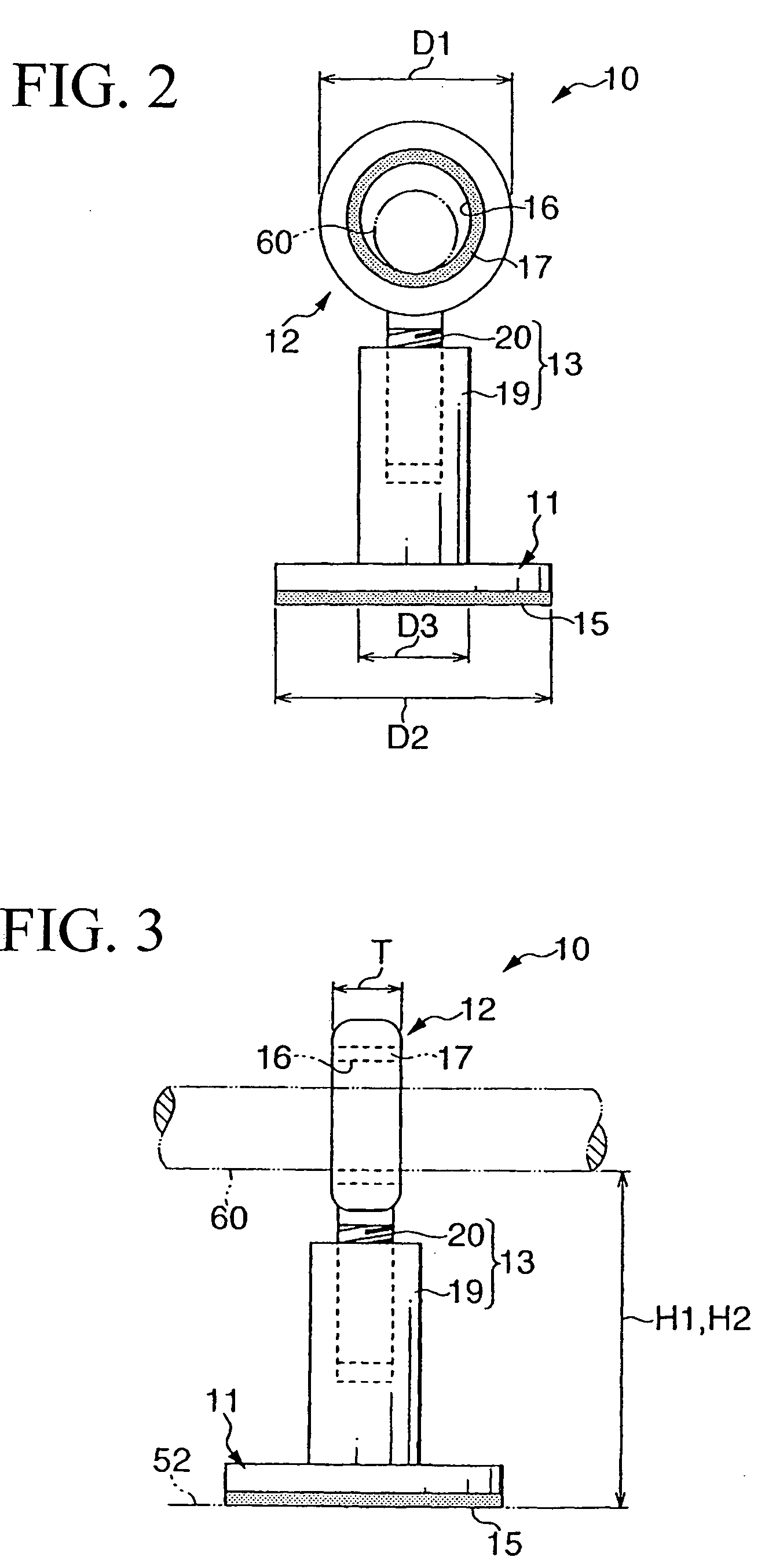 String replacement assistance apparatus