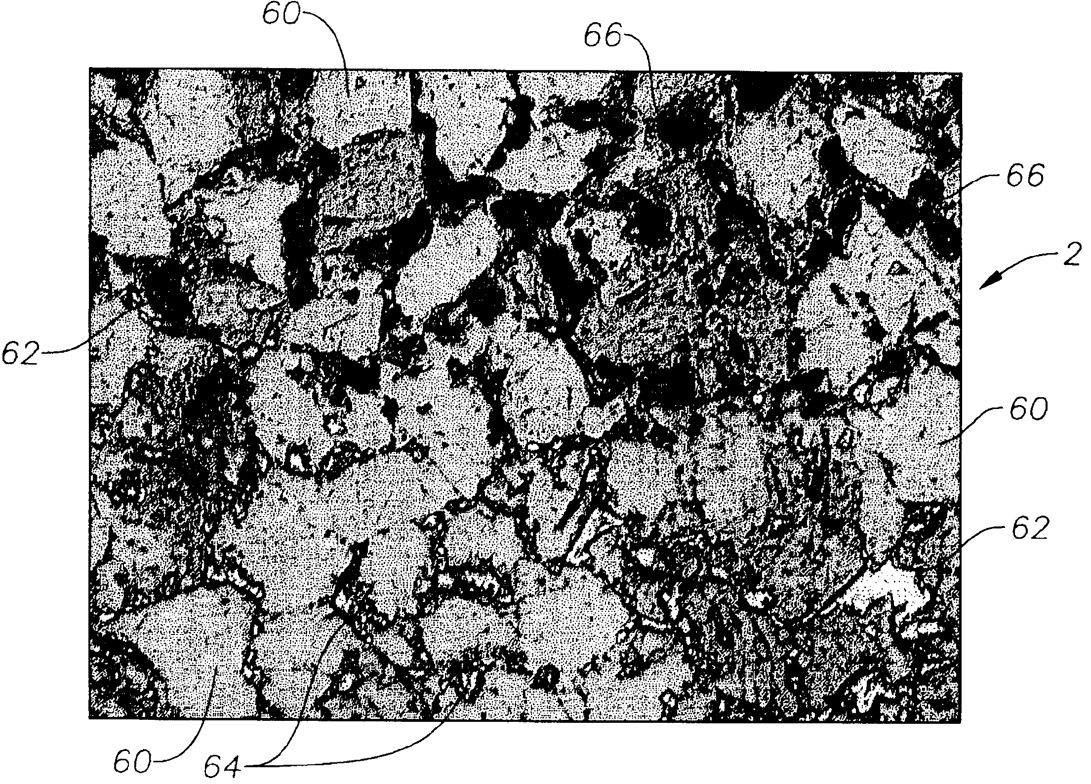 High volume density polycrystalline diamond with working surfaces depleted of catalyzing material