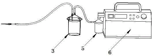 Cyst fluid suction device