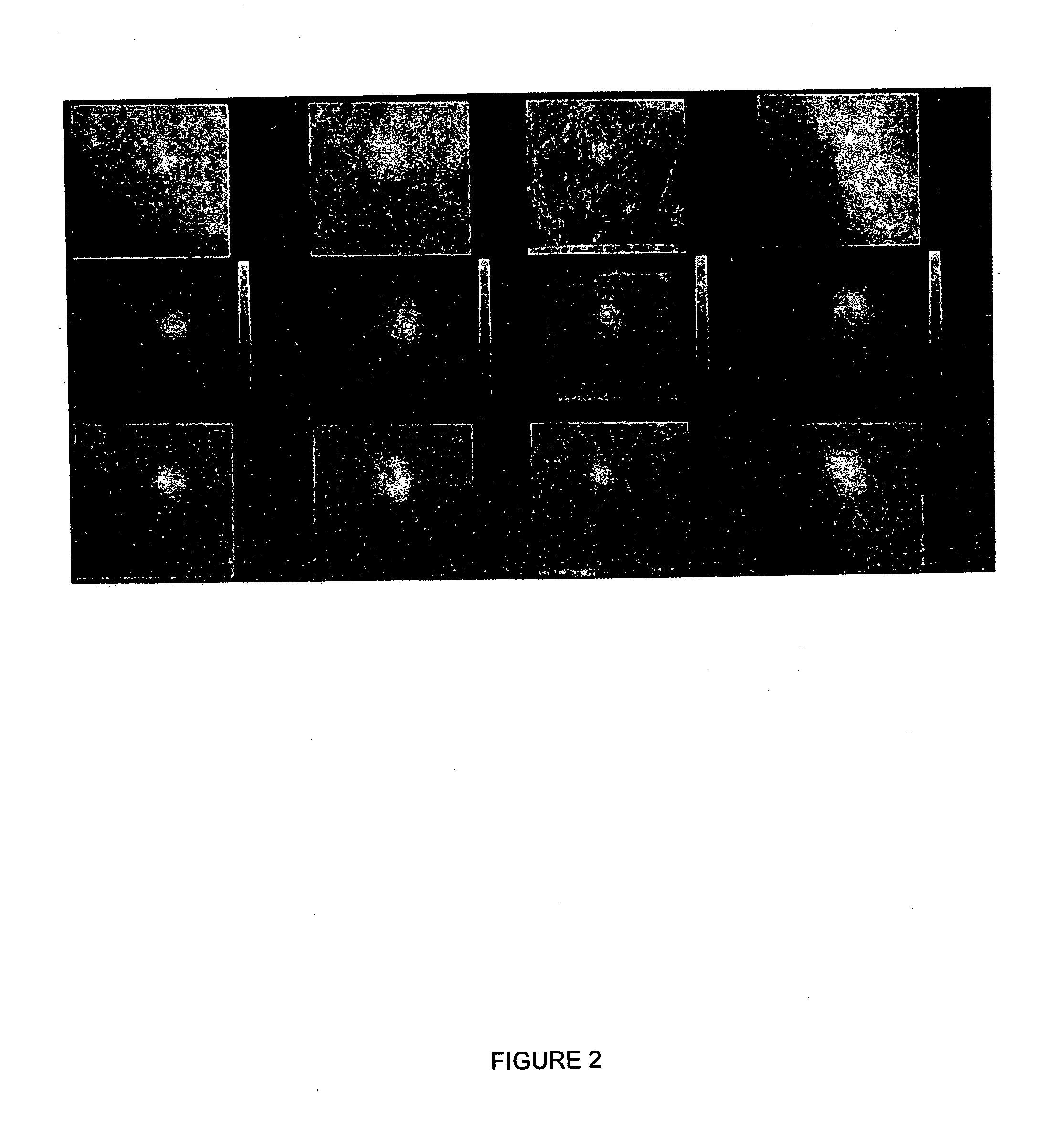 Method and apparatus for lesion localization using a dual modality x-ray/gamma biopsy system