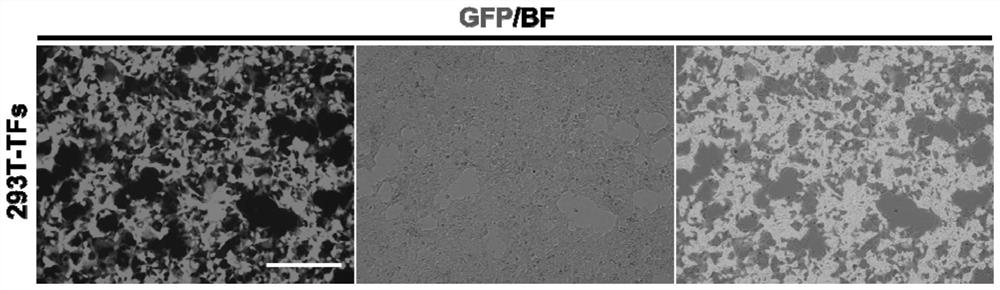 Method for preparing medium-sized spinous process neurons from non-neuronal cell transformation and application