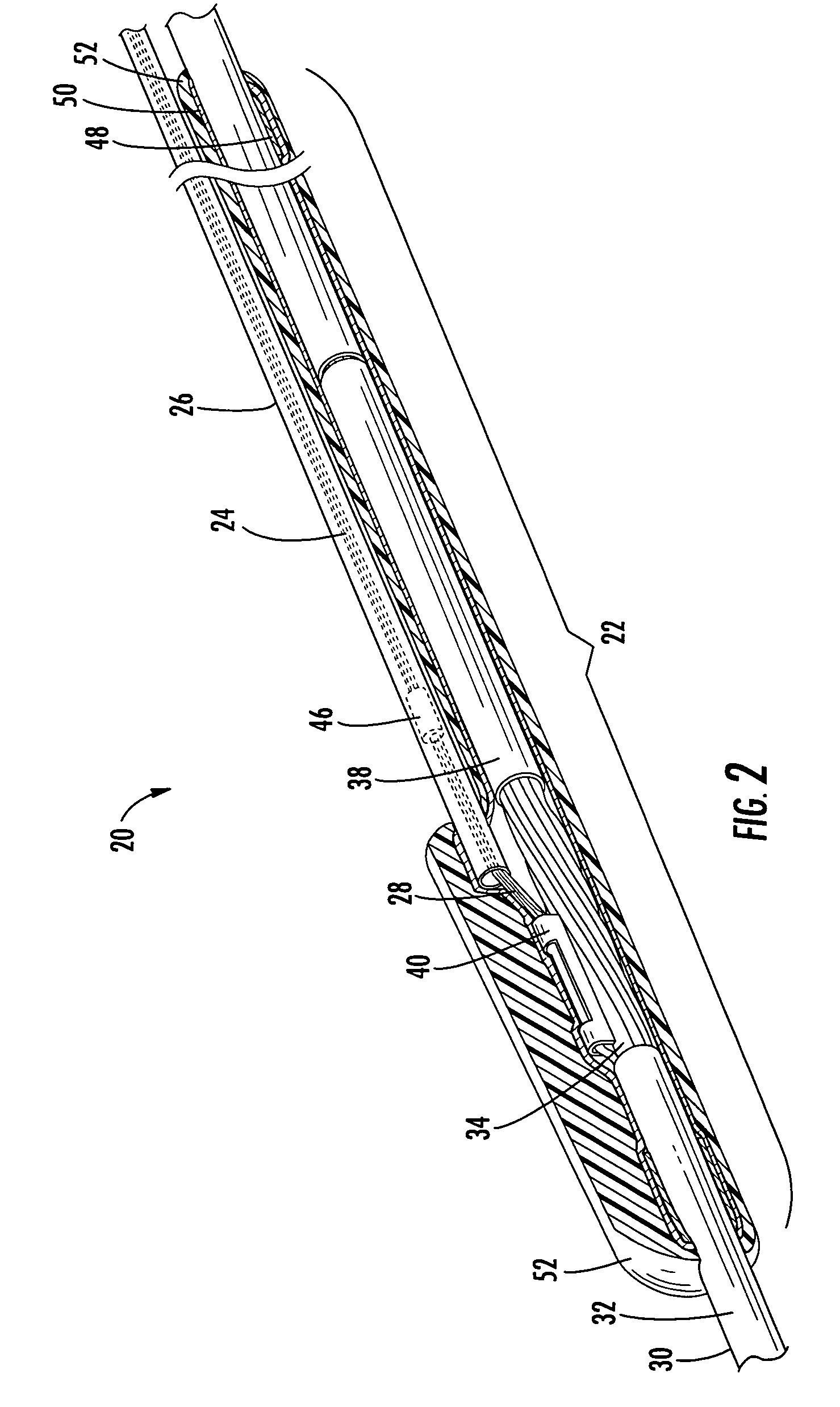 Distribution cable assembly having overmolded mid-span access location