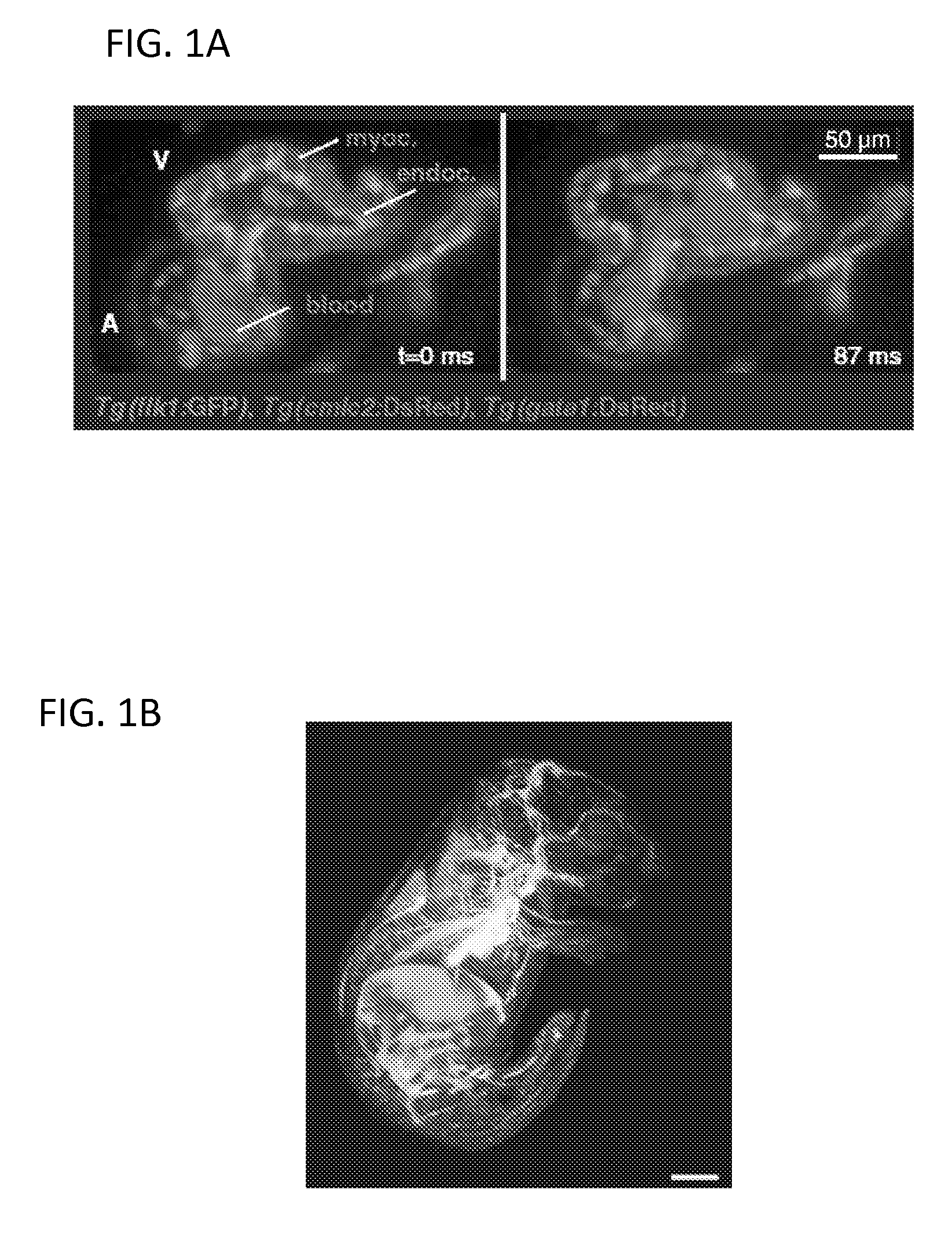 Multiple-photon excitation light sheet illumination microscope